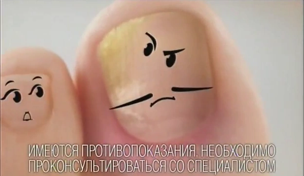 Микодерил - С грибком справляться научил реклама на ТВ