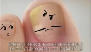 Микодерил - С грибком справляться научил